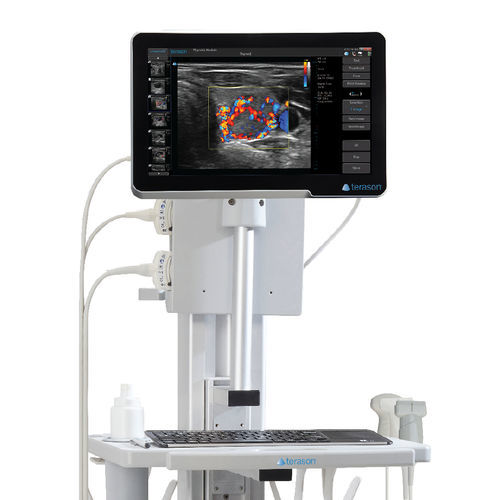 Ecografo portatile con carrello - uSmart® 3200T Plus - Terason - per ecografia multidisciplinare / in bianco e nero / con doppler a colori