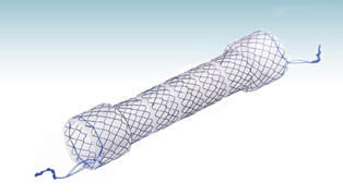 Stent esofageo - HANAROSTENT®BS (CCC) - M.I Tech