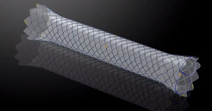 Stent colico - HANAROSTENT®TTS (CCC) - M.I Tech - rettale