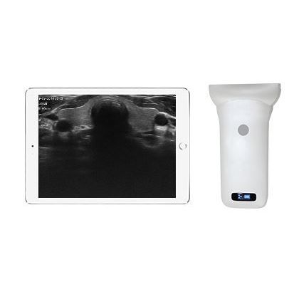Ecografo palmare - Sonostar Technologies - per ecografia multidisciplinare / in bianco e nero / con doppler a colori