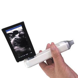 Ecografo palmare - XProbe - Sonostar Technologies - per ecografia multidisciplinare / in bianco e nero / con sonda wireless
