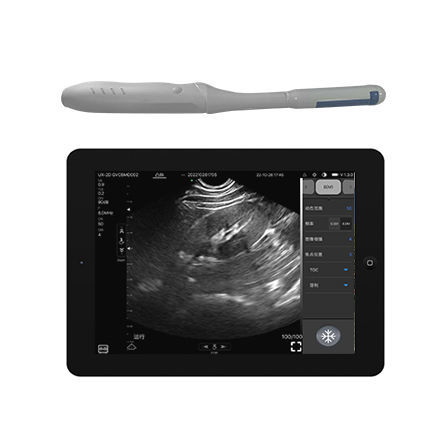 Ecografo palmare - CProbe-4TR  - Sonostar Technologies - per ecografia endovaginale / in bianco e nero / con doppler a colori