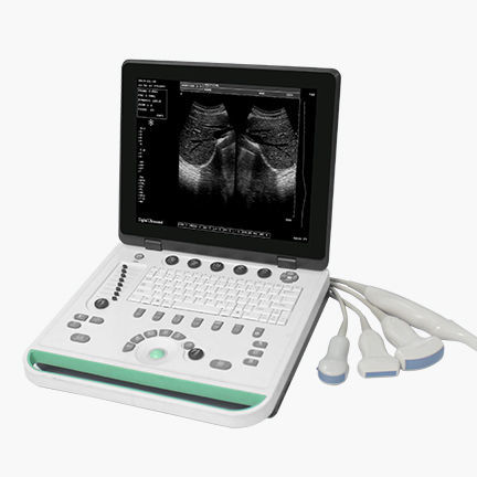 Ecografo portatile - SS-7 - Sonostar Technologies - per ecografia multidisciplinare / in bianco e nero / con console integrata