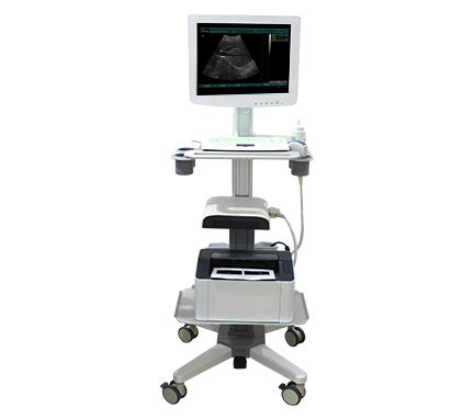 Ecografo su piattaforma compatto - SS-100 Touch Screen Trolley Ultrasound Diagnosis B - Sonostar Technologies - per ecografia multidisciplinare / con doppler a colori