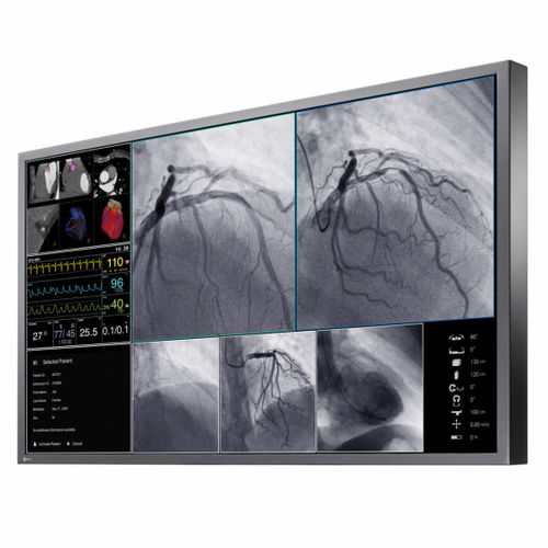 Monitor per sala operatoria - CuratOR® LX550W - EIZO GmbH - per diagnostica per immagini / 4K / 55"