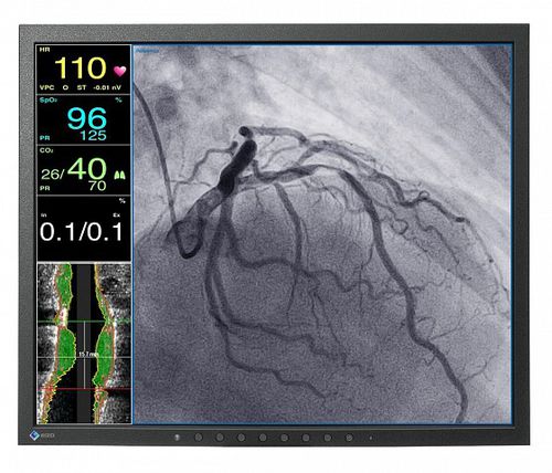 Monitor medico - CuratOR® LX1910 - EIZO GmbH - diagnostico / 19" / LCD