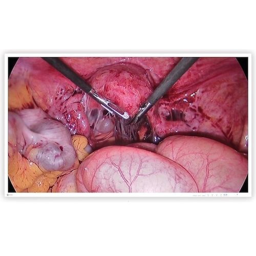 Monitor chirurgico - CuratOR® EX4342-3D - EIZO GmbH - medico / per sala operatoria / per endoscopia