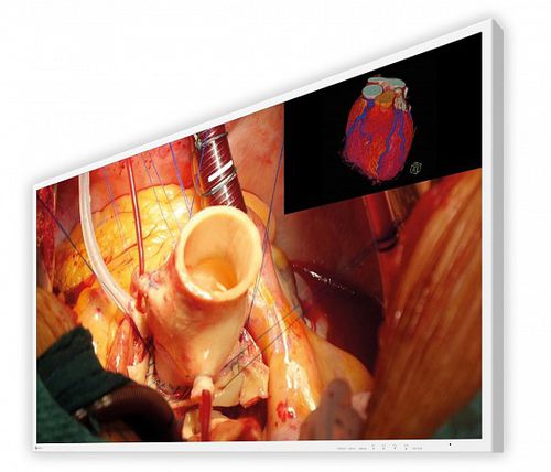 Monitor chirurgico - CuratOR® EX4342 - EIZO GmbH - medico / per sala operatoria / 4K