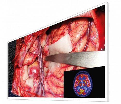 Monitor chirurgico - CuratOR® EX5542 - EIZO GmbH - medico / 4K / 55"