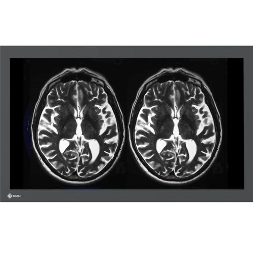 Monitor medico - LX3240-MR - EIZO GmbH - Full HD / 4K / 16:9
