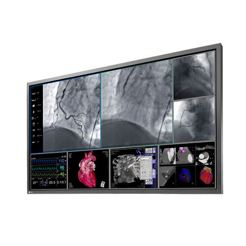 Monitor per sala operatoria - RadiForce® LS580W - EIZO GmbH - per diagnostica per immagini / ad alta definizione / 58"