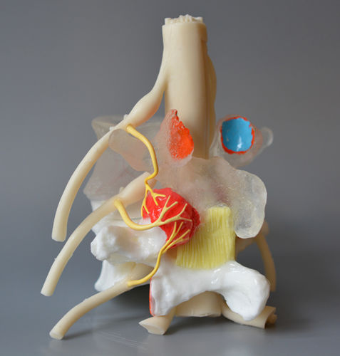 Modello anatomico di dischi intervertebrali - Medial Branch  - Dynamic Disc Designs Corp. - ad uso didattico / con nervi / bianco