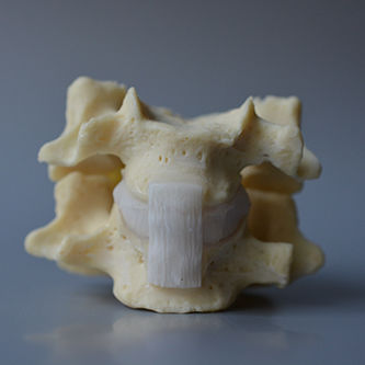 Modello anatomico di dischi intervertebrali - Professional CxH - Dynamic Disc Designs Corp. - di vertebre cervicali / ad uso didattico