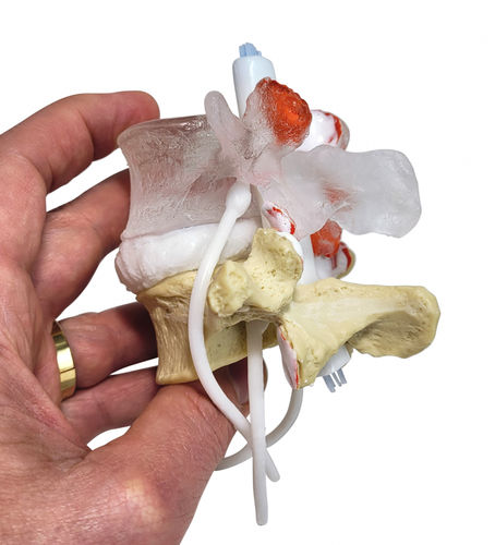 Modello anatomico di vertebre lombari - Professional LxH - Dynamic Disc Designs Corp. - di dischi intervertebrali / ad uso didattico / con nervi