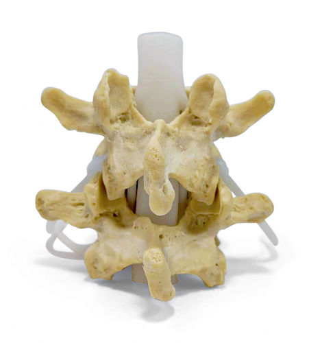 Modello anatomico di dischi intervertebrali - Classic LxH Dynamic - Dynamic Disc Designs Corp. - ad uso didattico / bianco