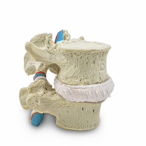 Modello anatomico di dischi intervertebrali - Audible Release - Dynamic Disc Designs Corp. - rachideo / ad uso didattico / bianco