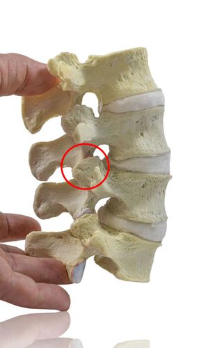Modello anatomico osseo - L2-5  - Dynamic Disc Designs Corp. - di vertebre / di colonna vertebrale lombare / ad uso didattico