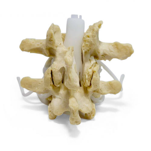 Modello anatomico lombare - Dynamic Disc Designs Corp. - rachideo / per chirurgia / ad uso didattico