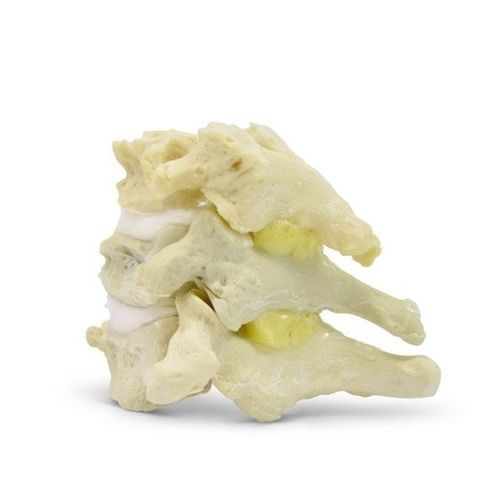Modello anatomico di dischi intervertebrali - Dynamic Disc Designs Corp. - rachideo / cervicale / ad uso didattico