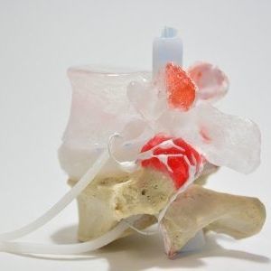 Modello anatomico di dischi intervertebrali - Dynamic Disc Designs Corp. - rachideo / di nervo / ad uso didattico