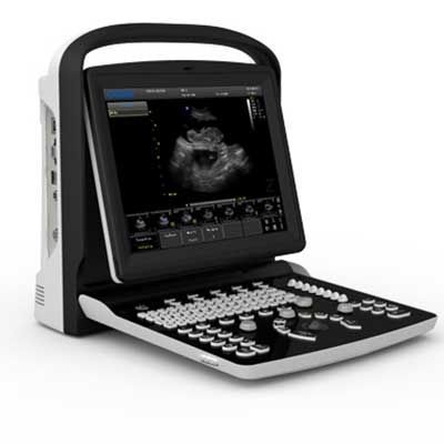 Ecografo veterinario portatile - Chison Eco3 - Diagnostic Imaging Systems - multiuso / per animali di piccola taglia / per animali di grossa taglia