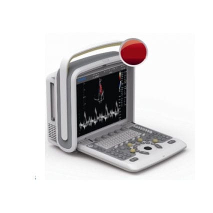 Ecografo veterinario portatile - Chison Q9 - Diagnostic Imaging Systems - multiuso / per animali domestici / con doppler a colori