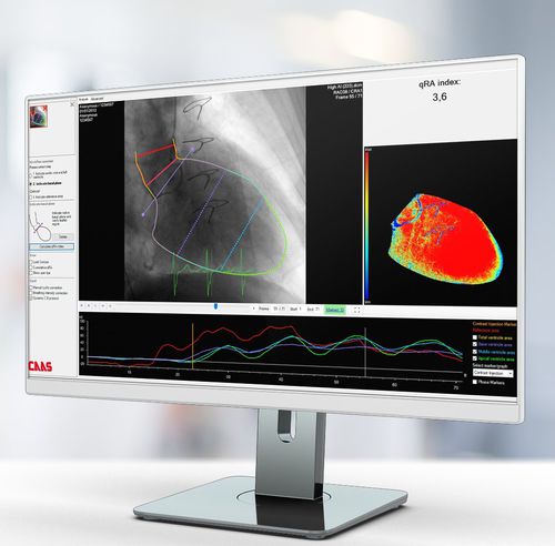 Software di analisi delle immagini - Pie Medical Imaging - diagnostico / di misura / di pianificazione del trattamento