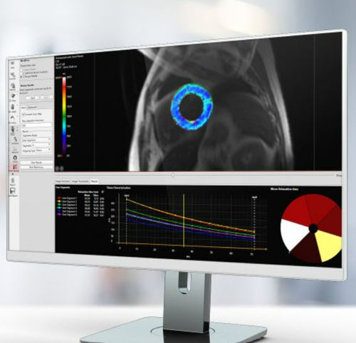 Software di analisi - Pie Medical Imaging - di visualizzazione / medico / clinico