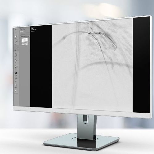 Software di ottimizzazione delle immagini - StentEnhancer - Pie Medical Imaging - di visualizzazione / medico / per cardiologia