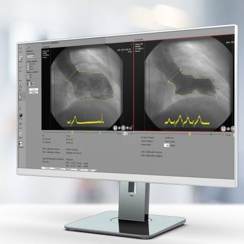 Software di analisi - RVA - Pie Medical Imaging - per reportistica / di calibrazione / di rilevamento dei contorni