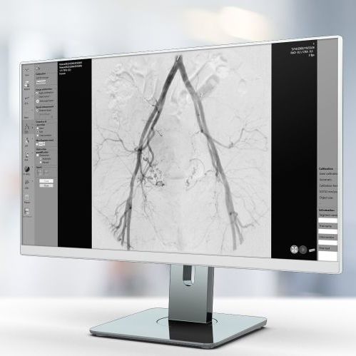 Software di analisi - QVA - Pie Medical Imaging - per reportistica / di trattamento / di valutazione