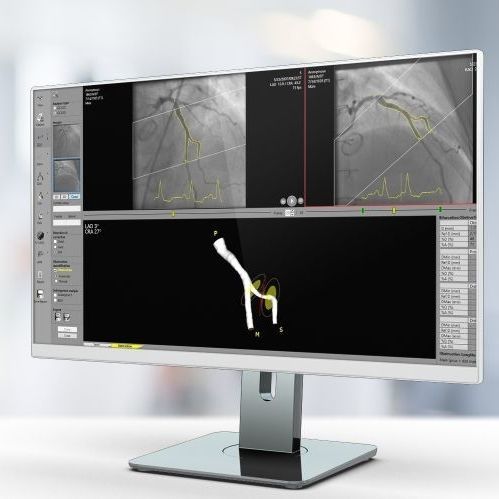 Software di analisi - QCA  - Pie Medical Imaging - per reportistica / di calibrazione / di rilevamento dei contorni