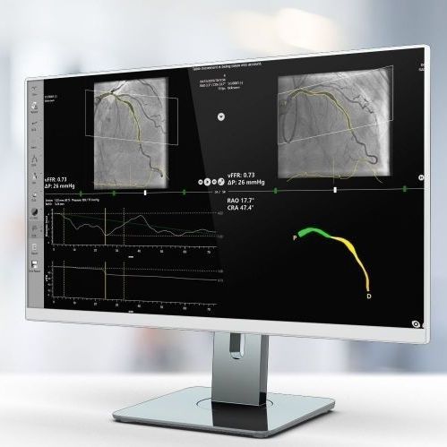 Software di analisi - vFFR - Pie Medical Imaging - di visualizzazione 3D / medico / per ospedale