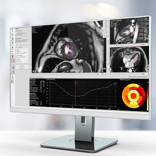 Software di analisi - Pie Medical Imaging - per reportistica / medico / MRI