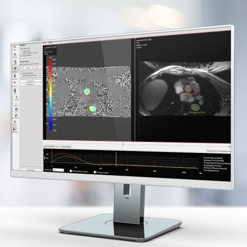 Software di analisi - Pie Medical Imaging - per reportistica / di visualizzazione / di ispezione