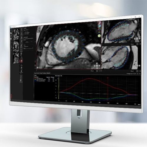 Software di analisi - MR Strain - Pie Medical Imaging - con sistema di tracciatura / medico / clinico