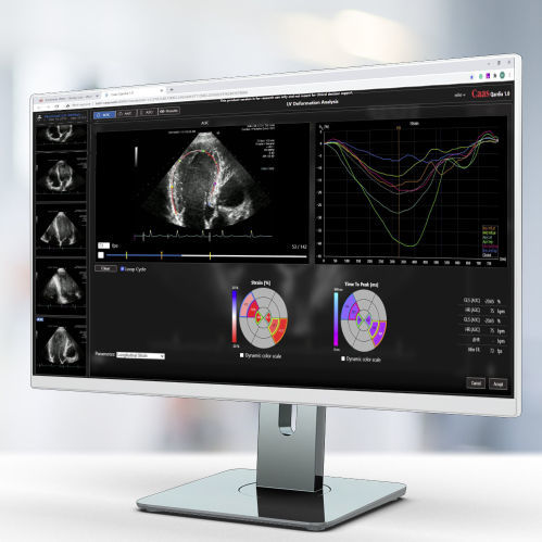 Software di analisi - Qardia - Pie Medical Imaging - per reportistica / di misura / medico