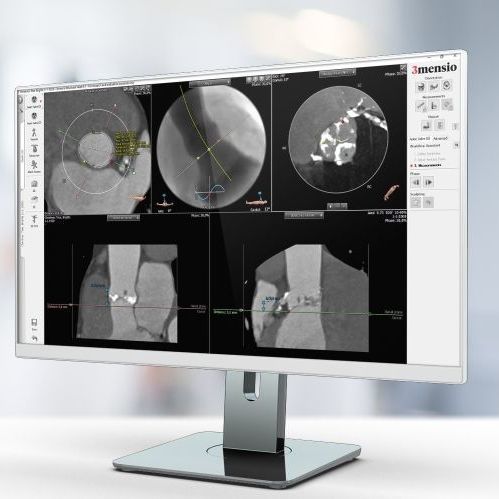 Software medico - Pie Medical Imaging - per tomografia computerizzata / per cardiologia / di analisi