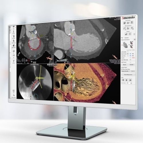Software di analisi - Pie Medical Imaging - per reportistica / di visualizzazione / di pianificazione