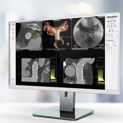 Software per reportistica - Pie Medical Imaging - di pianificazione / di trattamento / per ospedale