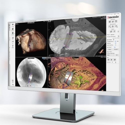 Software di analisi delle immagini - Pie Medical Imaging - per reportistica / d’importazione / medico