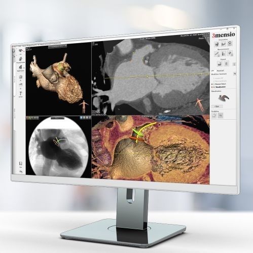 Modulo software medico - Pie Medical Imaging - per tomografia computerizzata / MRI / per appendicectomia