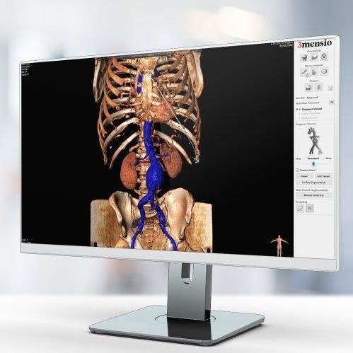 Software medico - Pie Medical Imaging - per tomografia computerizzata / per PACS / di file DICOM