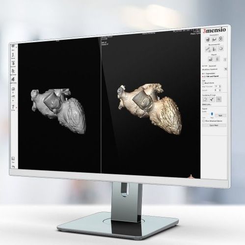 Software di acquisizione - Pie Medical Imaging - di stampa 3D / per tomografia computerizzata / da ricerca