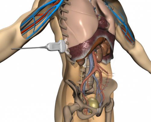Simulatore di paziente per ecografia - ICCU - Elevate Healthcare - per cure cliniche / per terapia intensiva / workstation