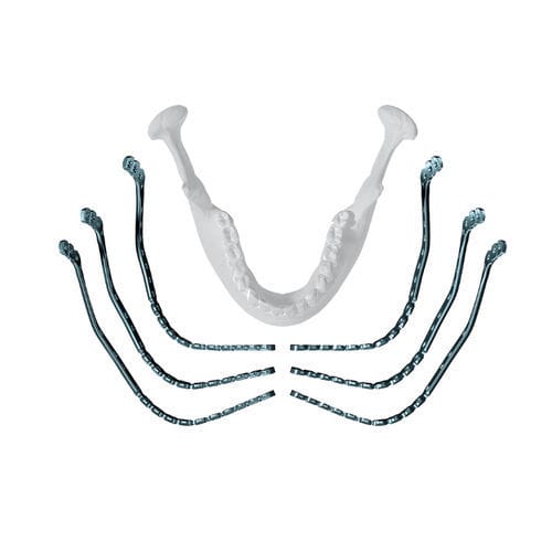 Placca di compressione per mandibola - MatrixMANDIBLE™  - Depuy Synthes - distale / bloccata / in metallo