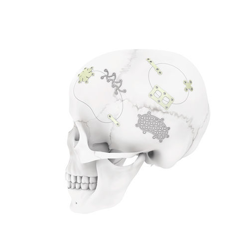 Sistema di fissazione cranica non assorbibile - MatrixNEURO™ - Depuy Synthes