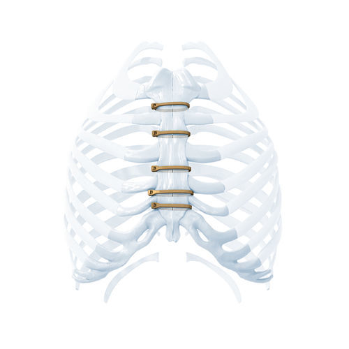 Filo per cerchiaggio ortopedico per chiusura dello sterno - ZIPFIX™ - Depuy Synthes - monofilamento metallico
