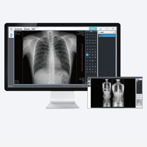 Software per radiografia - EConsole1  - DRTECH - di acquisizione / di elaborazione di immagine / osseo