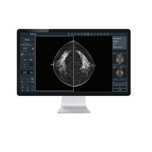 Software per imaging cellulare - RConsole2 : AIDIA - DRTECH - per mammografia / di analisi delle immagini / di gestione
